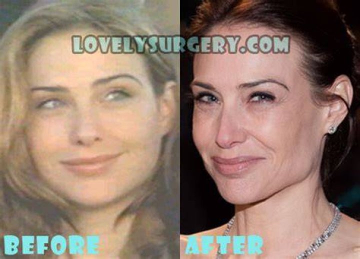 Claire Forlani Plastic Surgery Before and After