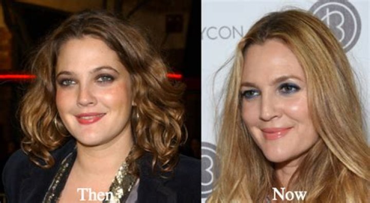 Drew Barrymore Plastic Surgery Before and After